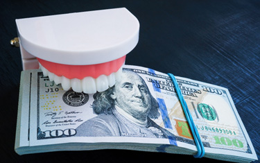 Mouth mold biting down on stack of money 