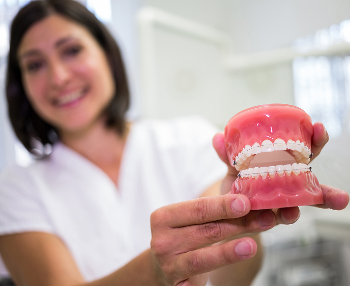 Snap-On Dentures