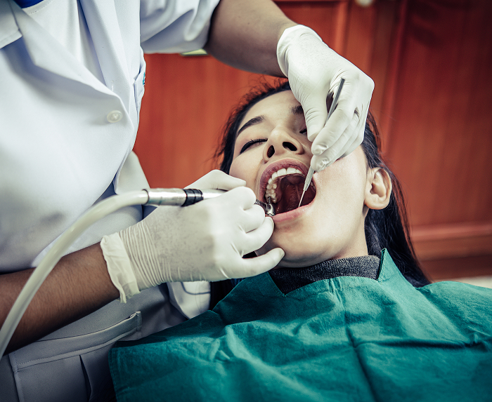 Dental Fillings