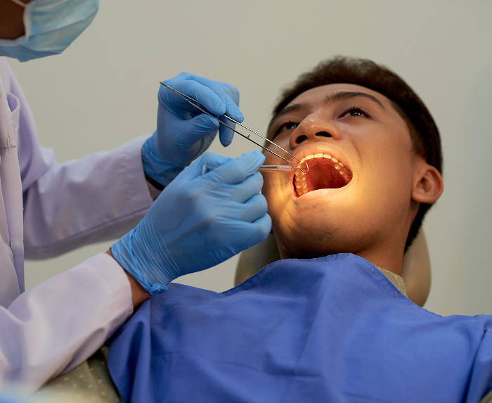 Oral Cancer Screenings