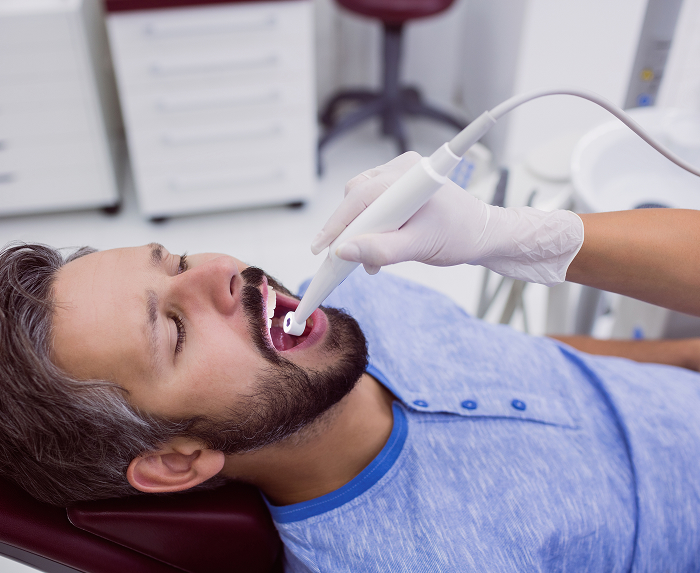 Dental Sealants
